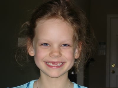 A002 TWO TEETH MISSING.JPG
